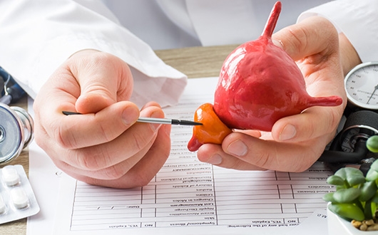 Prostate Disease